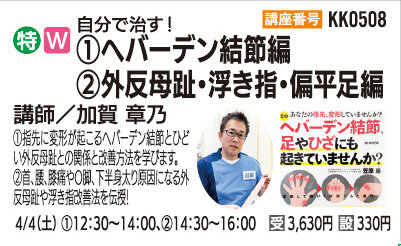 へバーデン結節